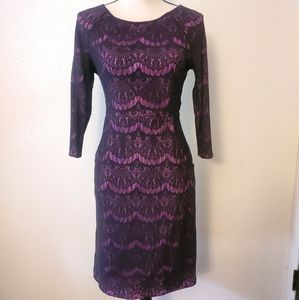 Lace Knee Length 3/4 Sleeve Dress with Pockets